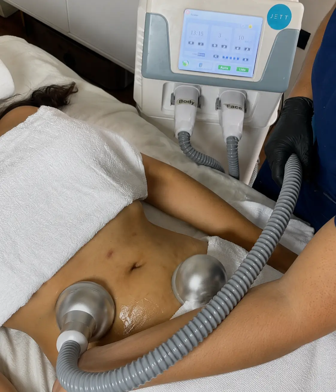 Lipoplastía HD en Dilaranja Medical Spa